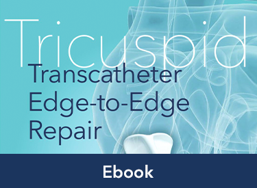 An image featuring the Tricuspid Transcatheter Edge-to-Edge Repair Ebook