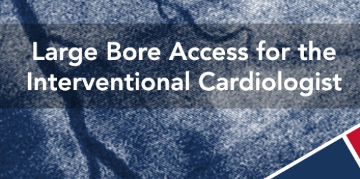 Large Bore Access for the Interventional Cardgiologist